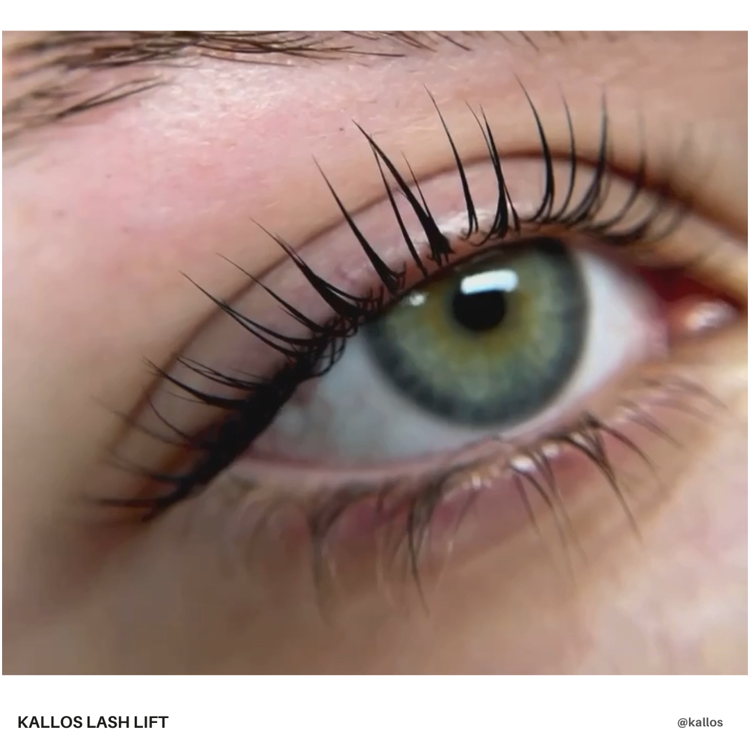 kallos vihanje trepalnic lash lift